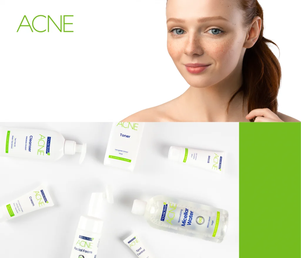 your-need-acne